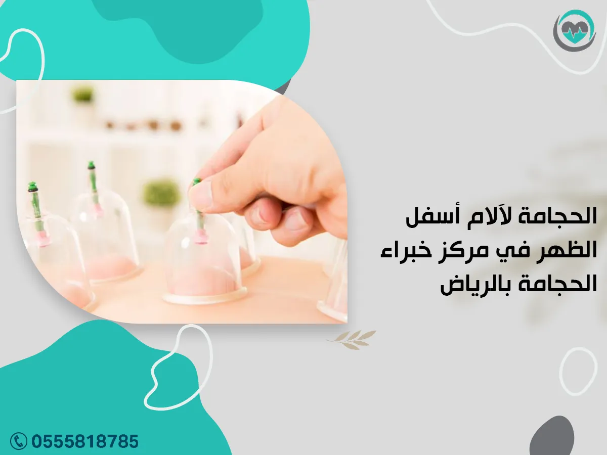 الحجامة لآلام أسفل الظهر في مركز خبراء الحجامة بالرياض