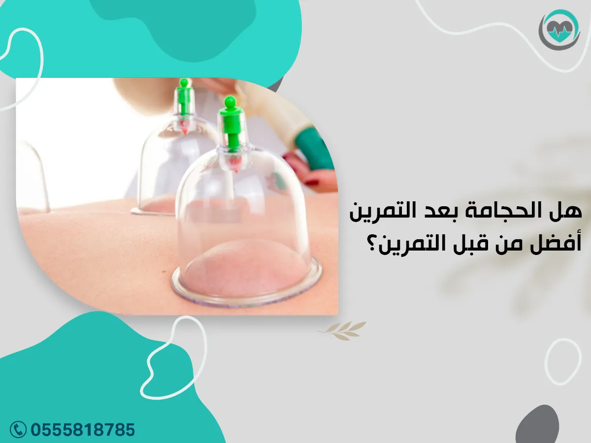 هل الحجامة بعد التمرين أفضل من قبل التمرين؟