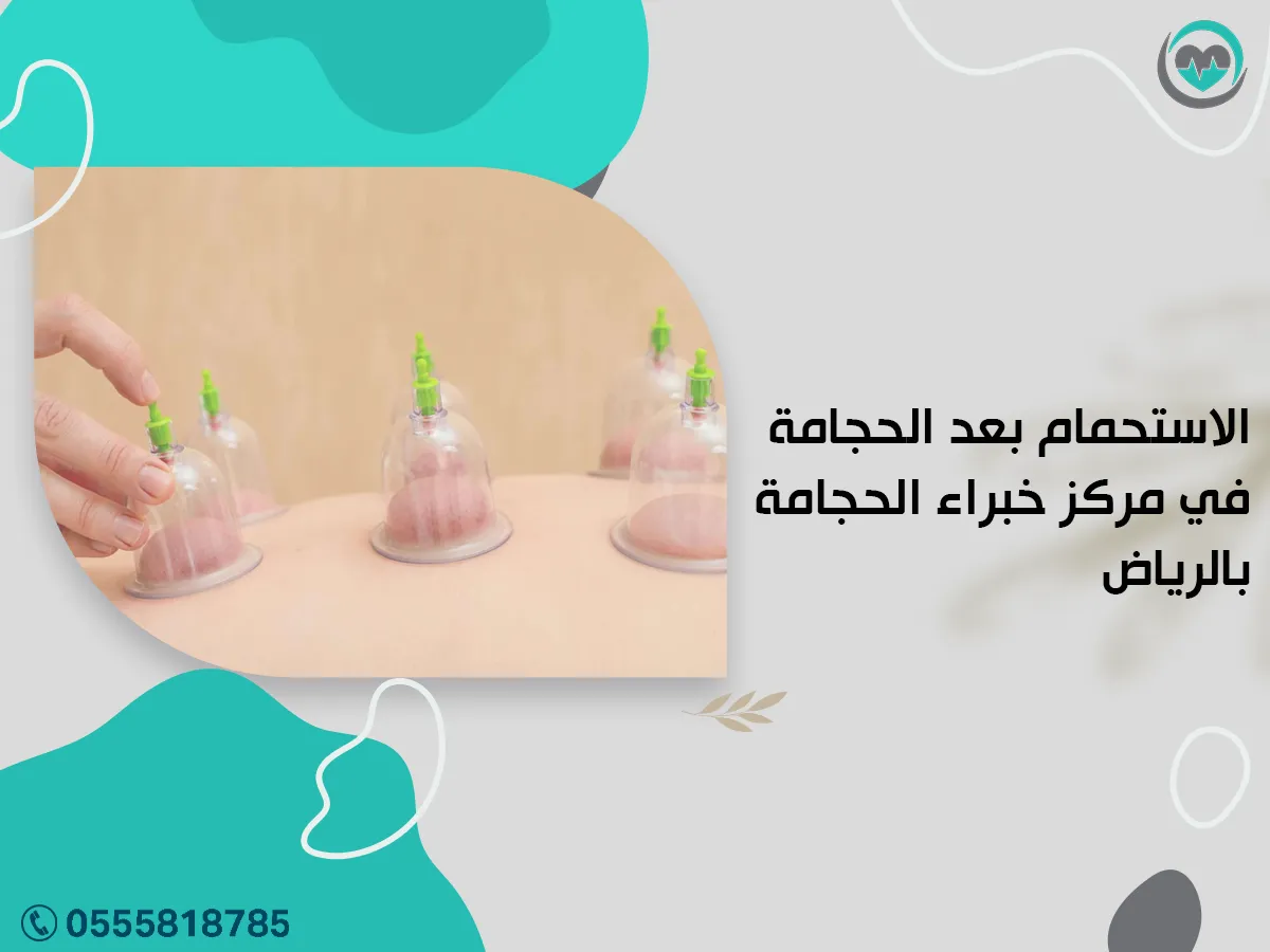 الاستحمام بعد الحجامة في مركز خبراء الحجامة بالرياض