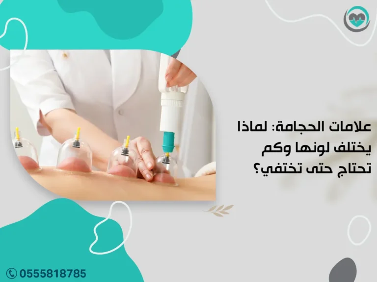 علامات الحجامة: لماذا يختلف لونها وكم تحتاج حتى تختفي؟
