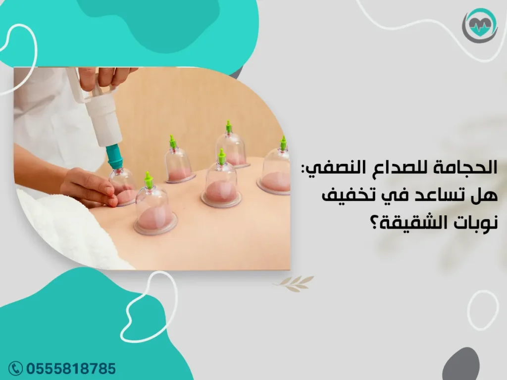 الحجامة للصداع النصفي