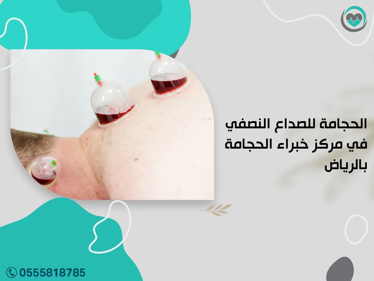 الحجامة للصداع النصفي في مركز خبراء الحجامة بالرياض