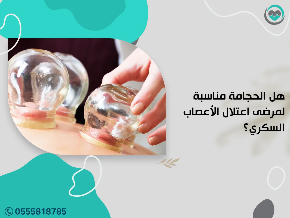 هل الحجامة مناسبة لمرضى اعتلال الأعصاب السكري؟
