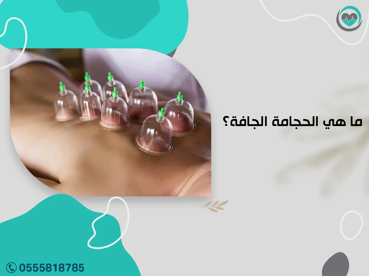 الحجامة الجافة؟