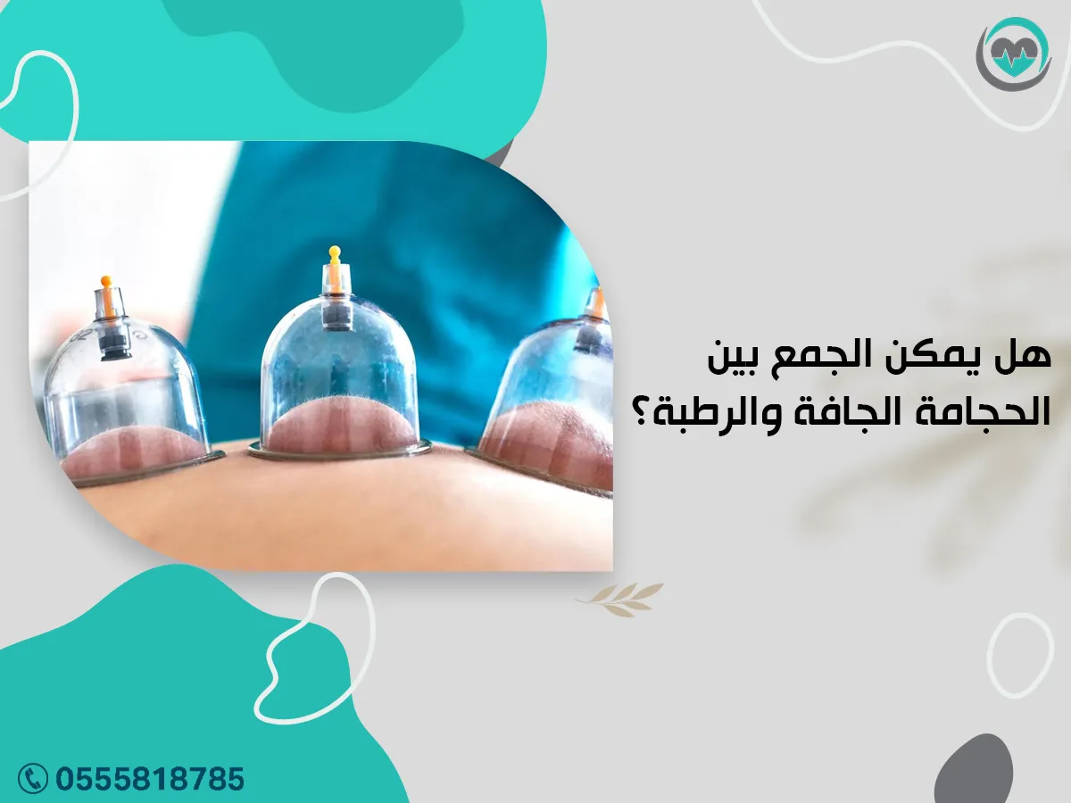 هل يمكن الجمع بين الحجامة الجافة والرطبة؟