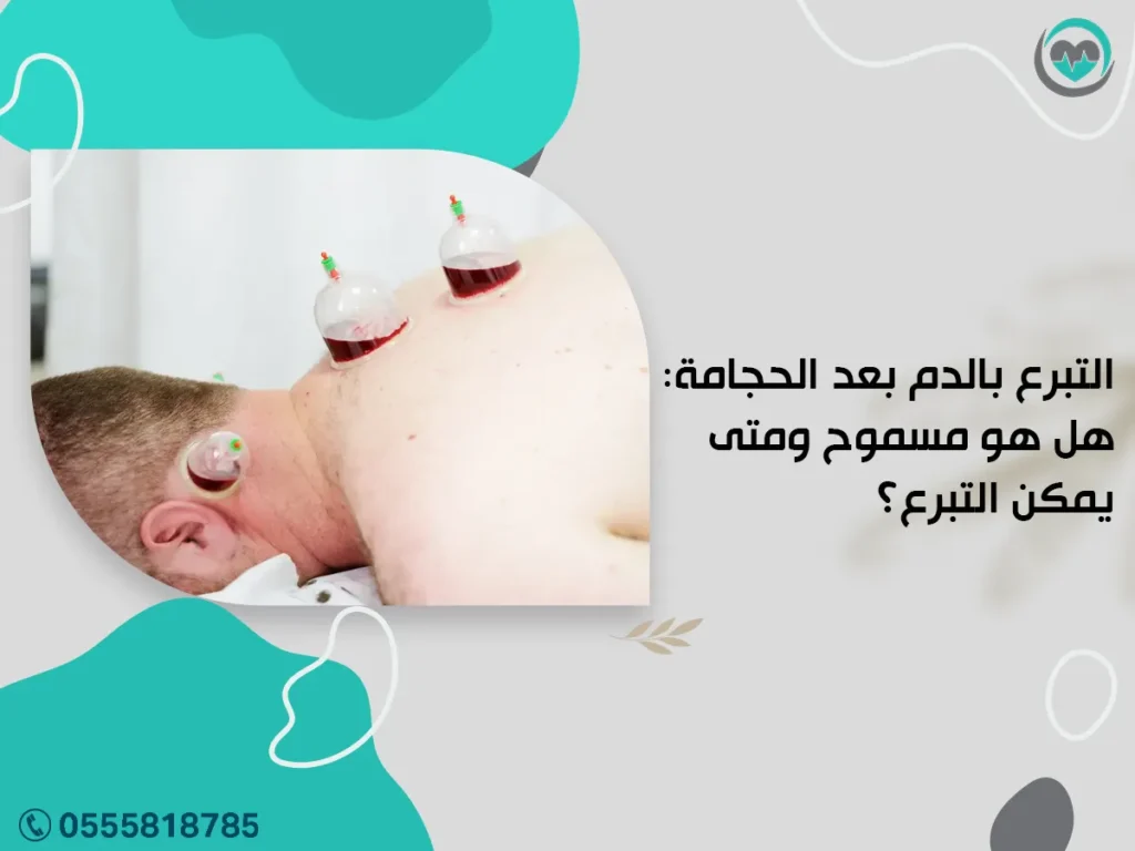 التبرع بالدم بعد الحجامة: هل هو مسموح ومتى يمكن التبرع؟