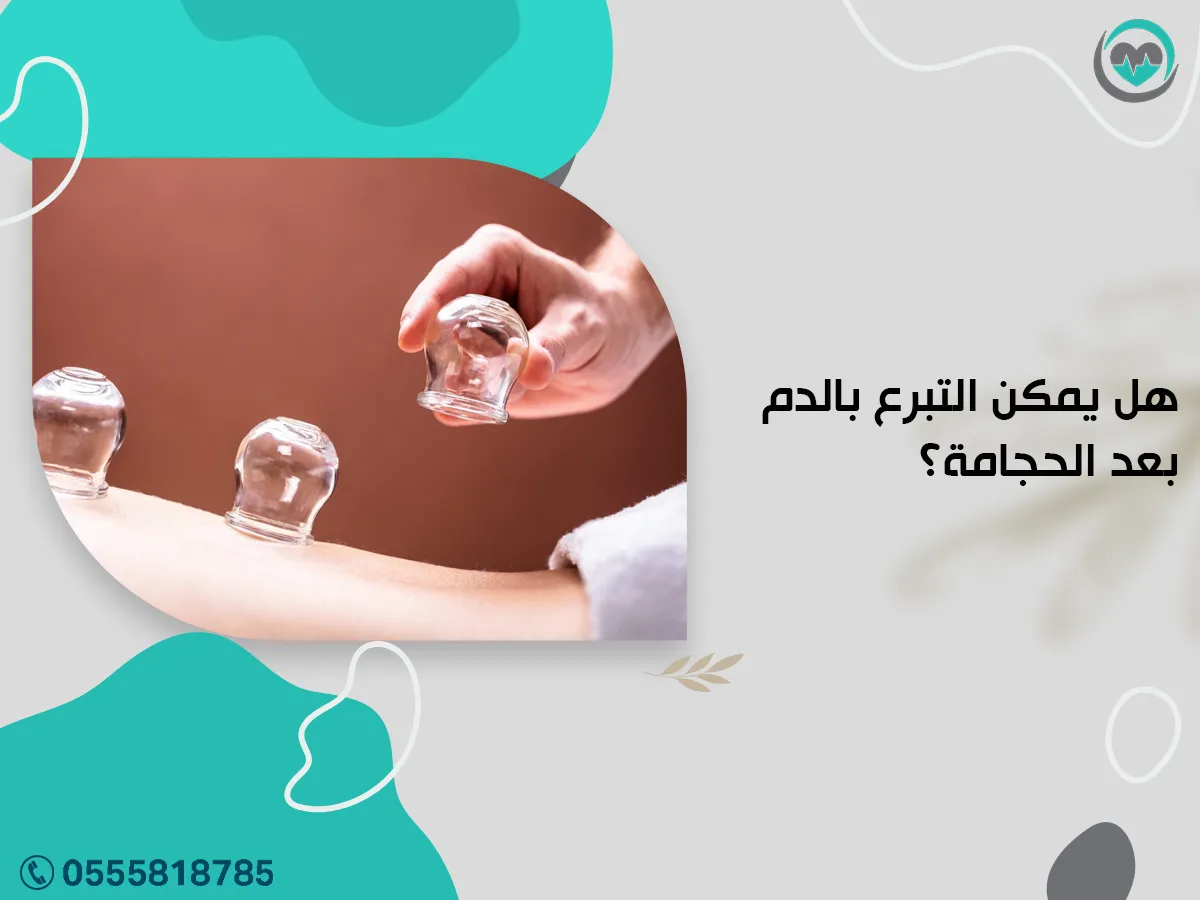 هل يمكن التبرع بالدم بعد الحجامة؟