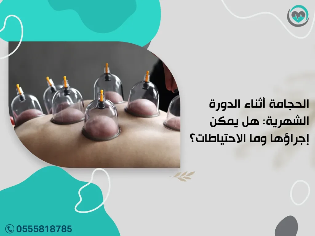الحجامة أثناء الدورة الشهرية: هل يمكن إجراؤها وما الاحتياطات؟