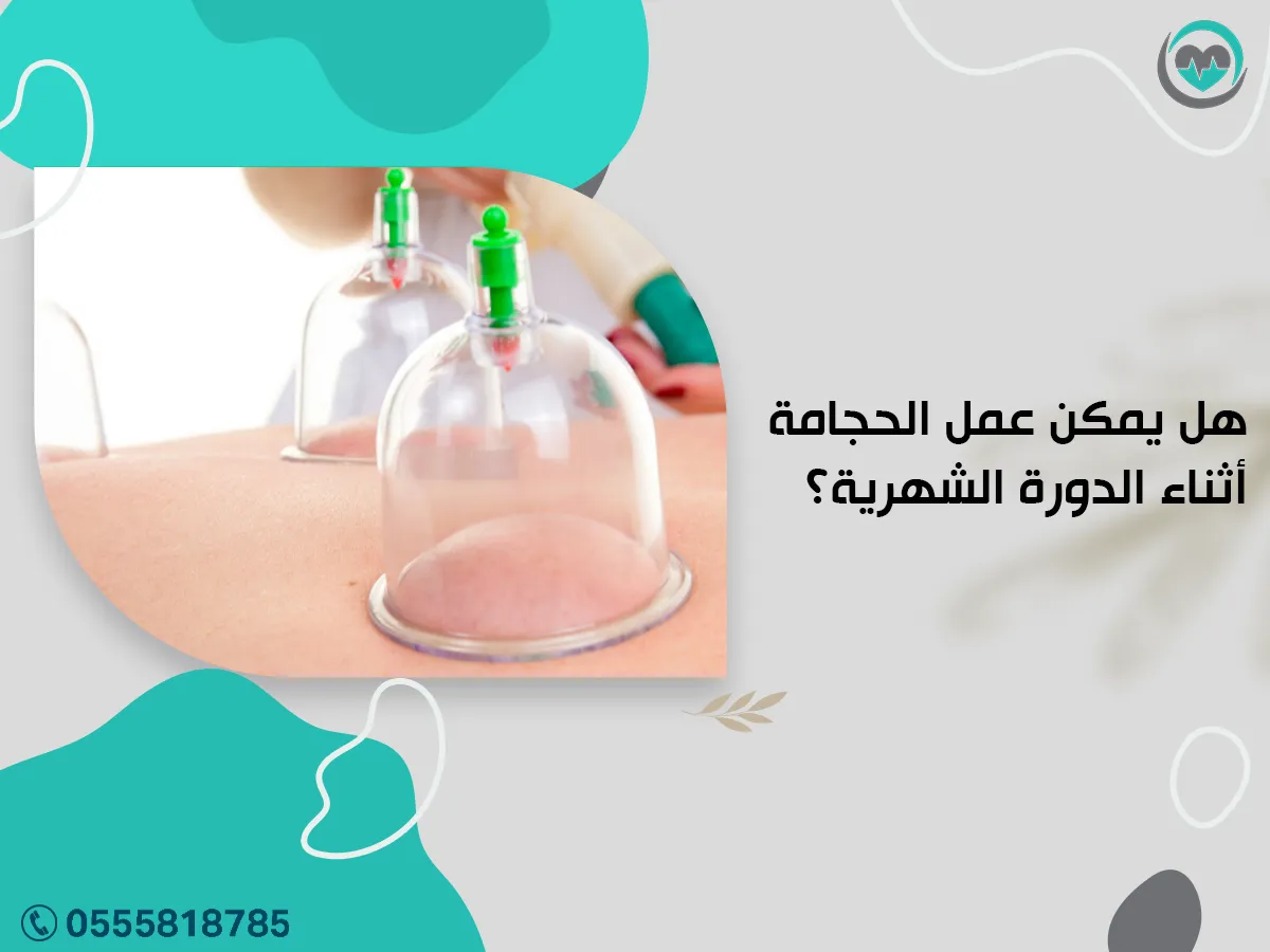 هل يمكن عمل الحجامة أثناء الدورة الشهرية؟