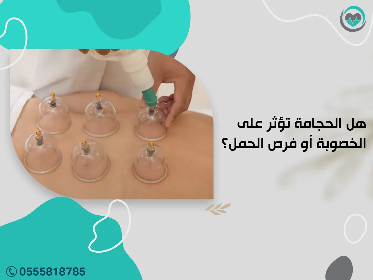 هل الحجامة تؤثر على الخصوبة أو فرص الحمل؟