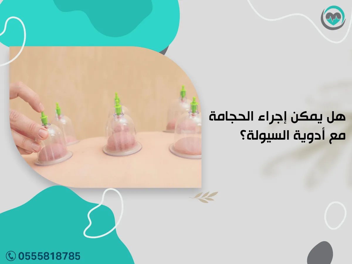 هل يمكن إجراء الحجامة مع أدوية السيولة؟