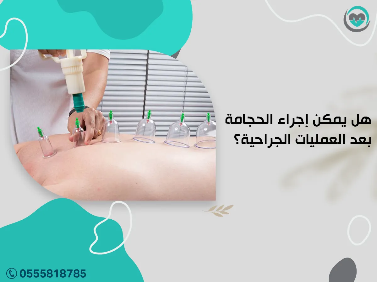 هل يمكن إجراء الحجامة بعد العمليات الجراحية؟