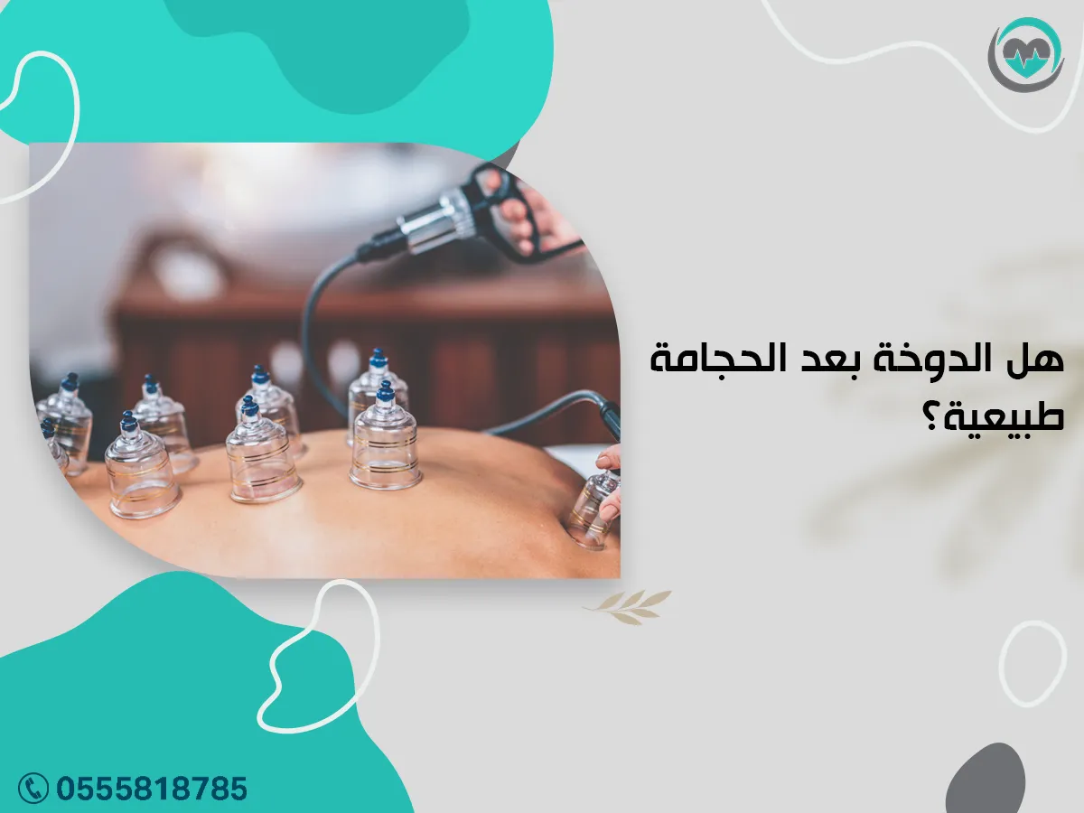 الدوخة بعد الحجامة طبيعية؟
