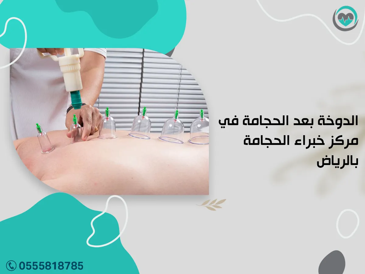الدوخة بعد الحجامة في مركز خبراء الحجامة بالرياض