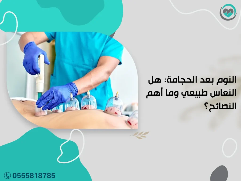 النوم بعد الحجامة: هل النعاس طبيعي وما أهم النصائح؟