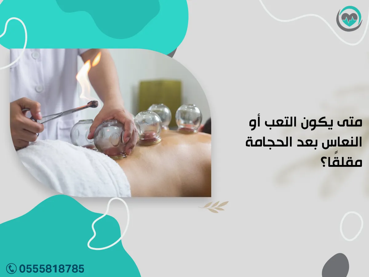 متى يكون التعب أو النعاس بعد الحجامة مقلقًا؟